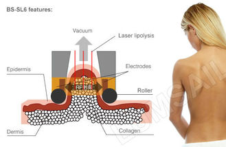 Cryolipolysis ไขมันตรึงร่างกายเครื่อง Slimmer Contouring ระบบสำหรับการแก้ไขไขมัน