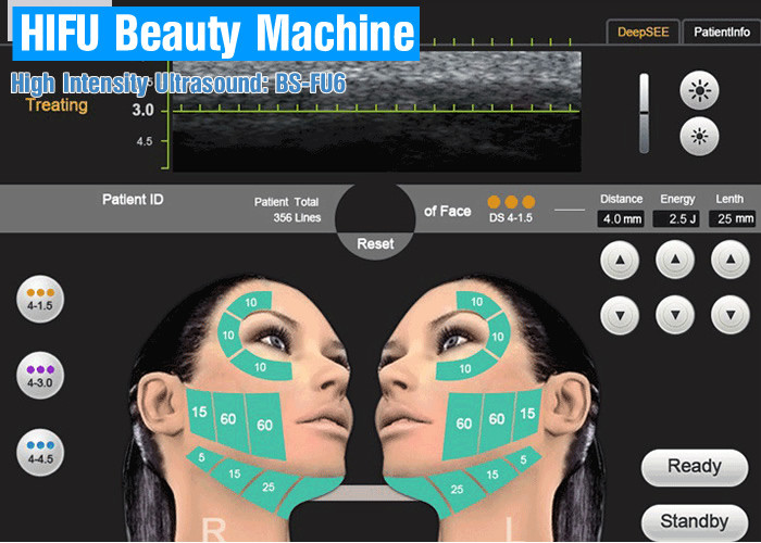Portable Hifu Beauty Machine High Intensity Focused Ultrasound For Precision Medical Imaging