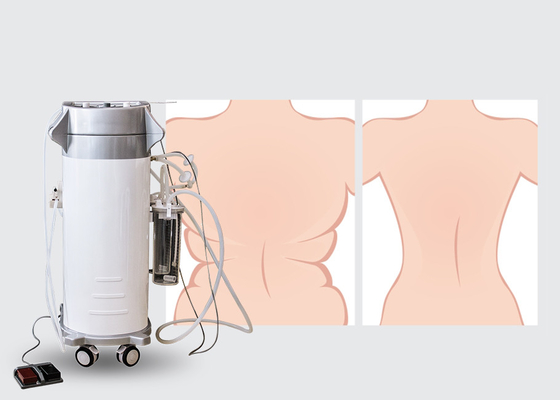300W อินพุตพลังงานเครื่องดูดไขมันผ่าตัด Lipo Slim Machine 2000ml ความจุขวดจัดเก็บ