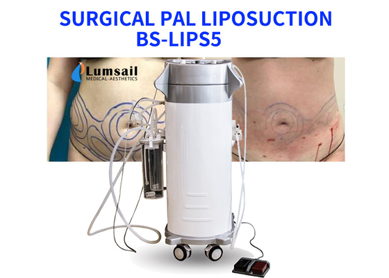 BS-LIPS5 อุปกรณ์ดูดไขมันกำลังสูง 300W สำหรับเต้านมคอและคาง