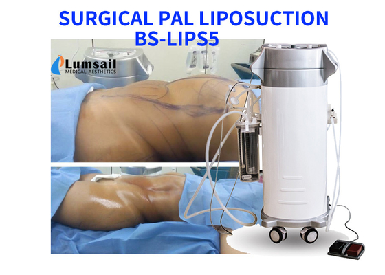 PAL เครื่องอัลตราโซนิกการผ่าตัดดูดไขมันอุปกรณ์ความงามลดน้ำหนักด้วยชุด Cannula