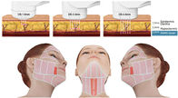 Skin Rejuvenation Machine HIFU Machine Face Lift With Non - Invasive Technology